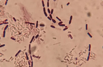 Postbiotici
